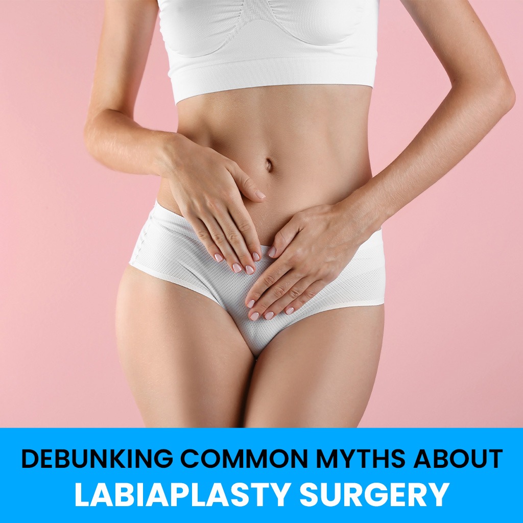 Debunking Myths About Labiaplasty Surgery
