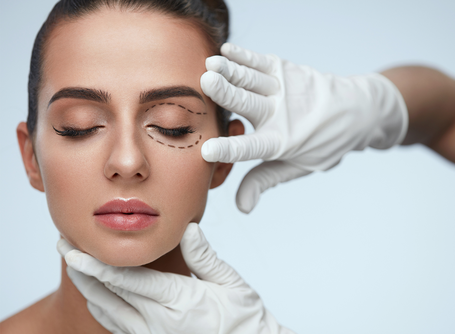 Blepharoplasty in Andheri