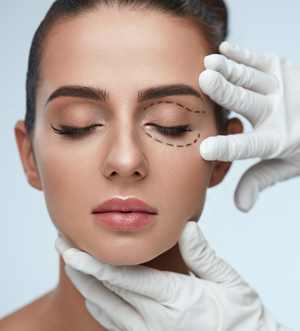 Blepharoplasty in Andheri