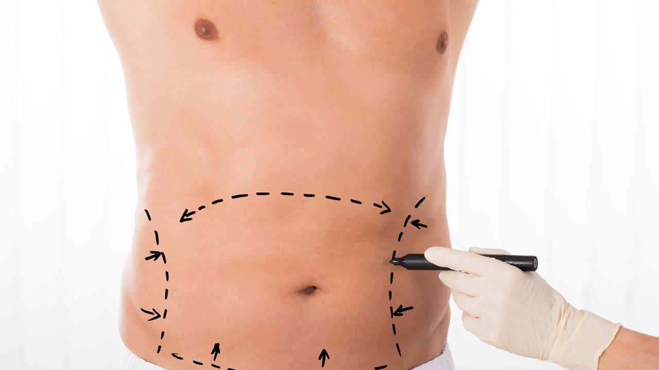 liposuction in Andheri, Mumbai