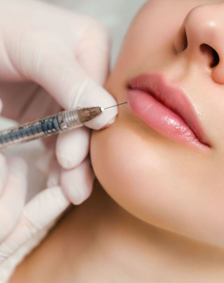 A syringe being used for lip enhancement.