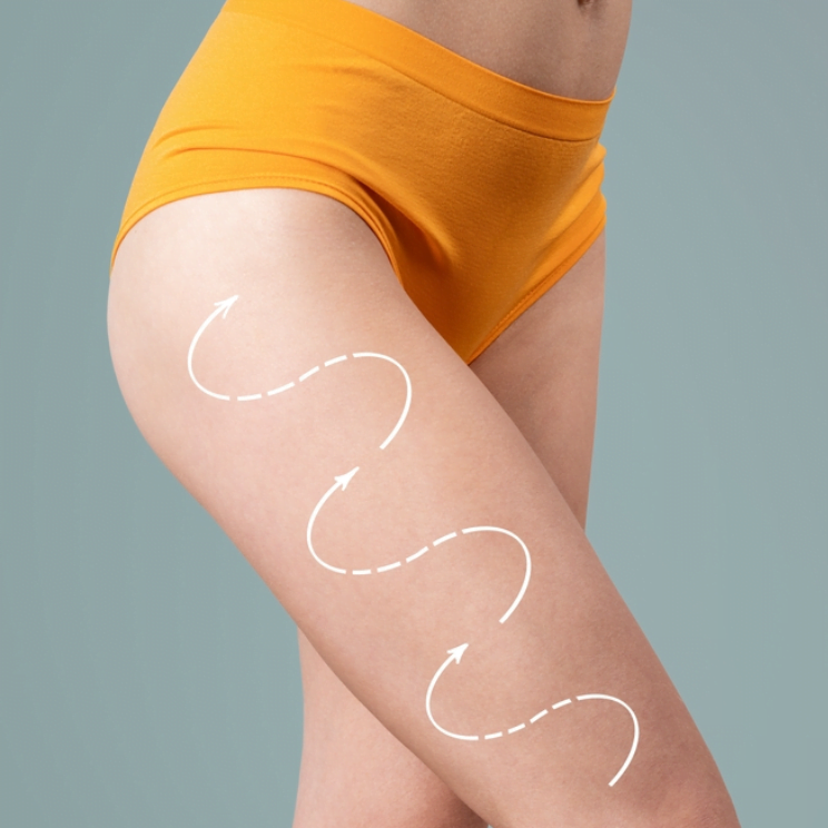 Woman's thigh with contouring arrows.