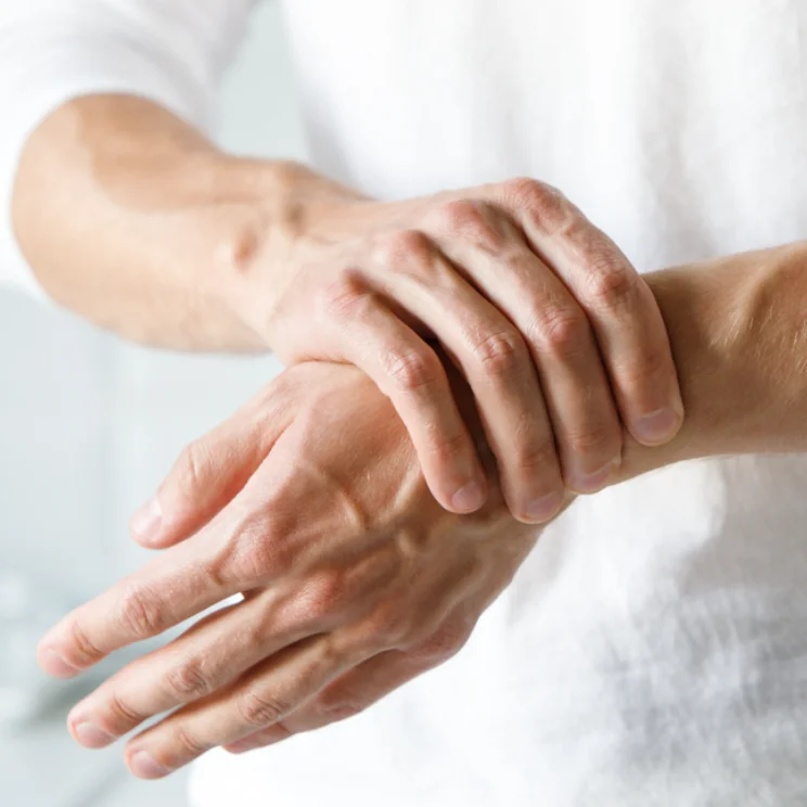 syndromic hands