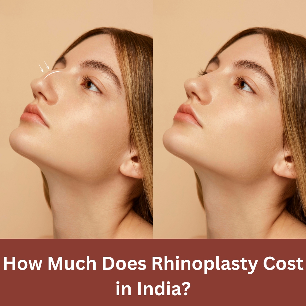 Cost of rhinoplasty surgery in India