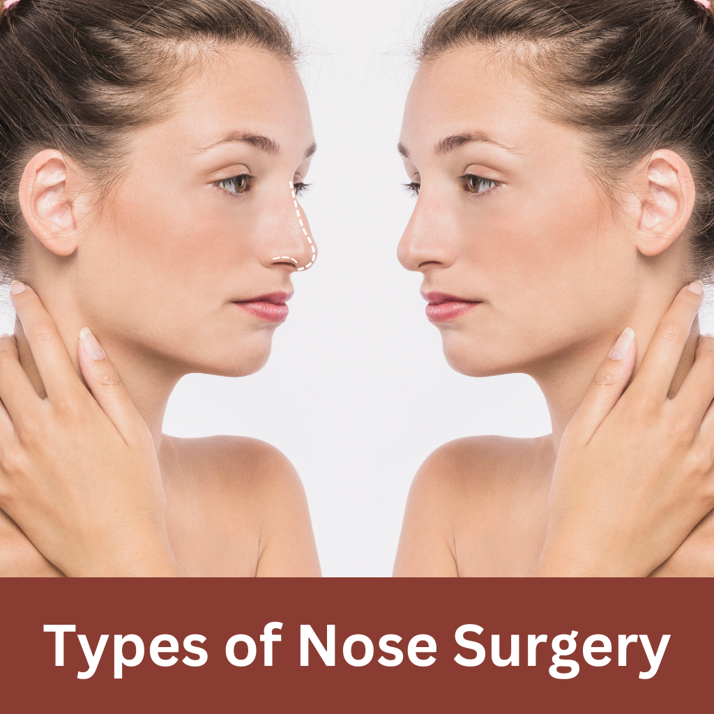 comparison of before and after nose surgery