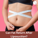 Can fat return after liposuction?