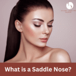 What is a Saddle Nose?