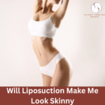 Will Liposuction Make Me Look Skinny?