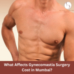 What Affects Gynecomastia Surgery Cost in Mumbai?
