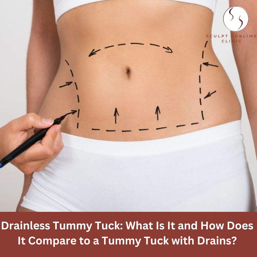 Marked abdomen indicating surgical planning for a tummy tuck procedure.