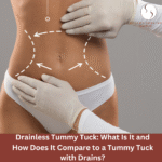 Drainless Tummy Tuck: What Is It and How Does It Compare to a Tummy Tuck with Drains?