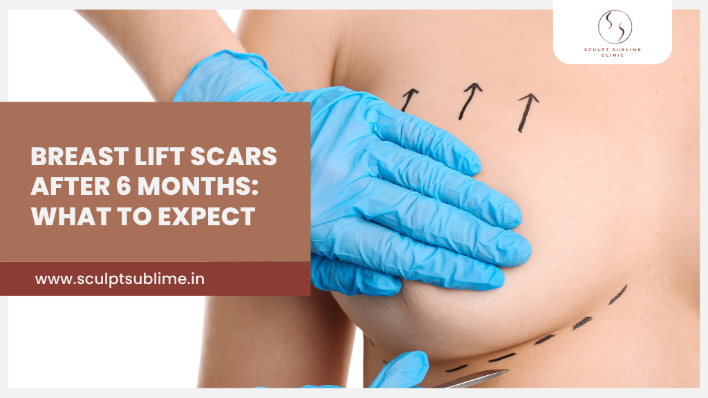 A close-up of a woman's chest with surgical markings and a professional wearing blue gloves, symbolizing post-breast lift care and recovery.