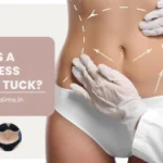Drainless Tummy Tuck: What Is It and How Does It Compare to a Tummy Tuck with Drains?