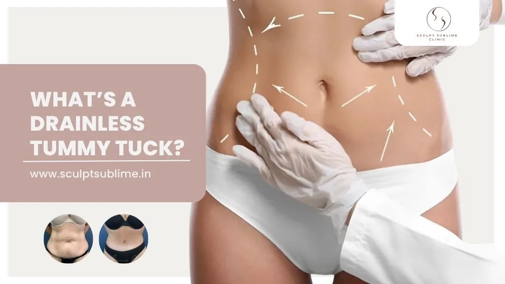 Close-up of a woman's abdomen with markings, showcasing a drainless tummy tuck procedure.