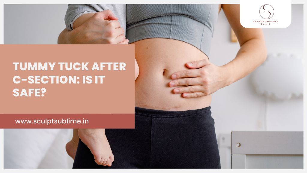 Thinking of a tummy tuck post-C-section? Discover safety and timing with Sculpt Sublime Clinic.