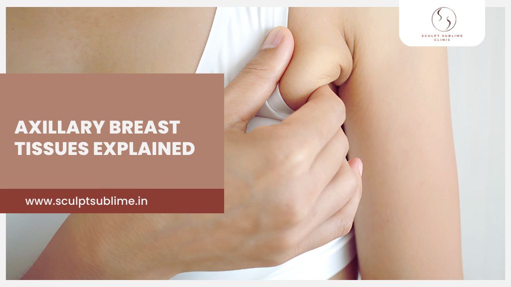 Axillary breast tissue near armpit explained by Sculpt Sublime Clinic