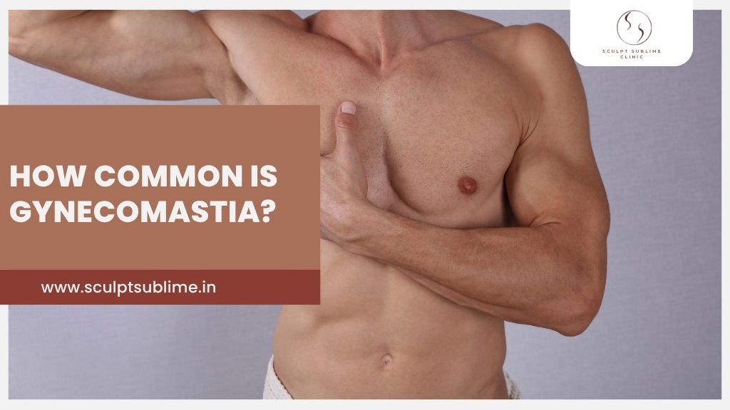 A fit man covering his chest with his hand, highlighting male chest contour concerns related to gynecomastia, with the text “How common is gynecomastia?” and Sculpt Sublime Clinic branding.