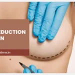 Everything You Need to Know About Breast Reduction Surgery in Mumbai