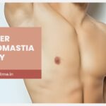 Life After Gynecomastia Surgery: Results and Confidence Boost