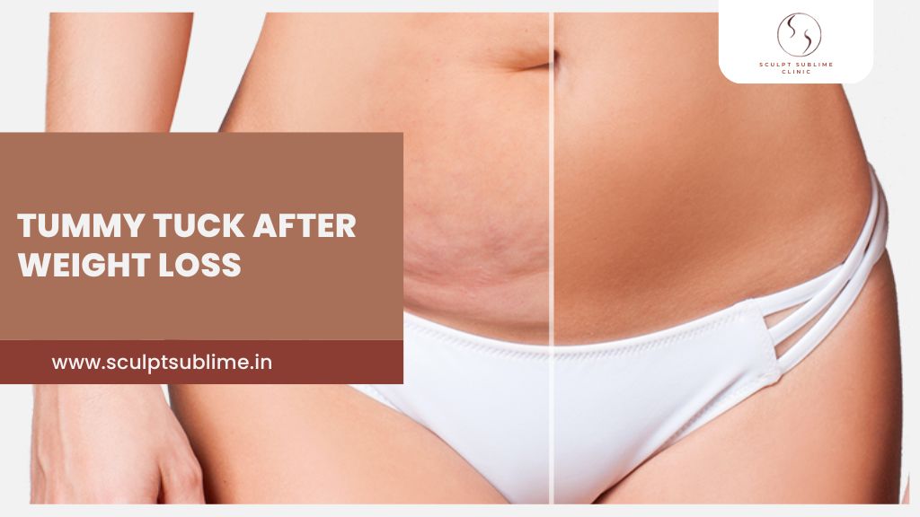 Before and after tummy tuck results showing improved abdomen after weight loss