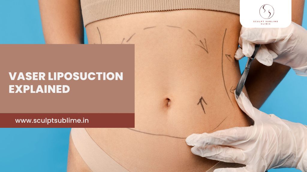 Surgeon marking abdominal areas for VASER liposuction during a body contouring procedure.