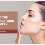 A Guide To The First Week Of Chin Lipo Recovery