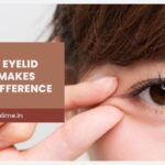 Stop Looking Tired: The Permanent Fix for Heavy, Drooping Eyelids You’ve Overlooked