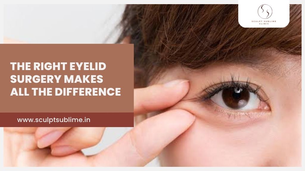 Woman gently lifting eyelid to illustrate precise eyelid surgery for refreshed eyes