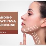 Double Chin Surgery Explained: Liposuction vs Neck Lift