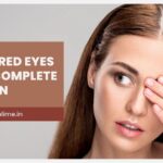 Can Eyelid Surgery Fix Both Under-Eye Bags and Sagging Skin?