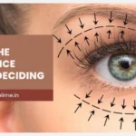 Upper vs Lower Blepharoplasty: Key Differences and Should You Get Both?