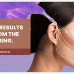 Best Age to Get a Facelift in Mumbai: When Does the Investment Make the Most Sense?