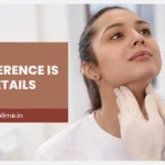 Double Chin Surgery Mumbai 2026: 7 Things Sculpt Sublime Does Differently