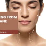 Deep Plane Facelift Recovery Guide