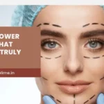 Upper vs Lower Blepharoplasty: Which Do You Need?