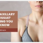 What Is Axillary Breast Tissue? Everything You Need to Know