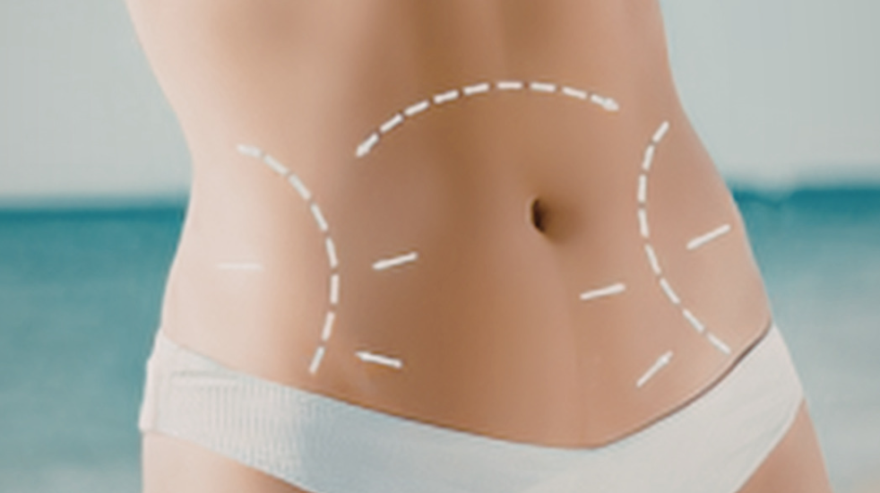 360 Waist Contouring