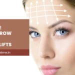 Brow Lift vs Forehead Lift: Which Procedure Do You Need?