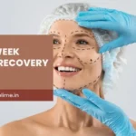 Facelift Recovery in Mumbai: Mistakes to Avoid at Every Stage