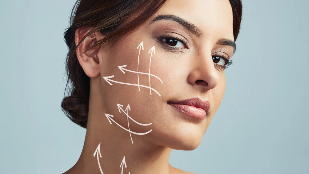 Facelift Surgery