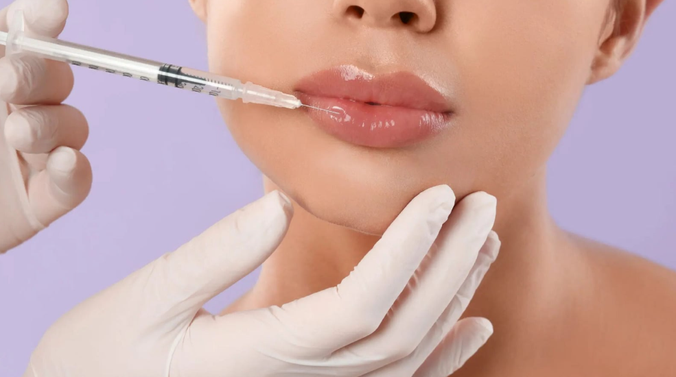 Lip Volumization