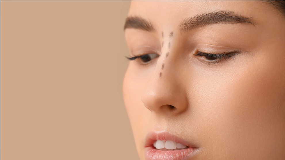 Rhinoplasty Surgery