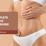 Tummy Tuck Recovery Week by Week: Complete Timeline