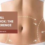 Mini vs Full Tummy Tuck: Which Abdominoplasty Surgery in Mumbai Is Right for You?