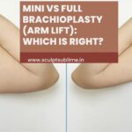 Mini vs Full Brachioplasty (Arm Lift): Which Is Right?
