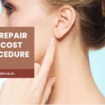 Earlobe Repair Surgery Cost & Procedure Guide