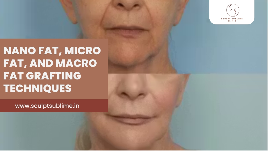 Nano Fat vs Micro Fat vs Macro Fat