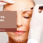 MACS Lift vs Traditional Facelift: Benefits & Which Is Right for You?