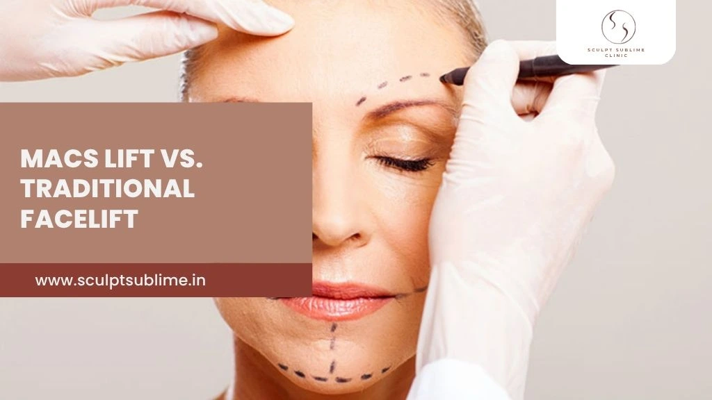 MACS LIFT vs FACELIFT SURGERY