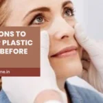 Questions to Ask Your Plastic Surgeon Before Surgery